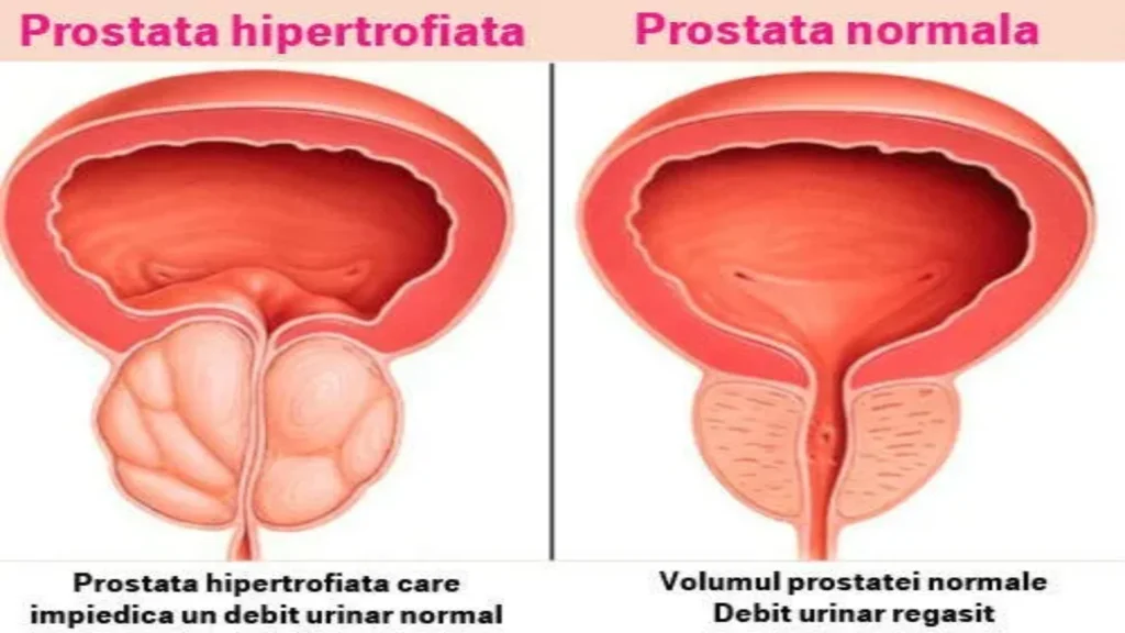 Prostovit narudžba - popust - službena stranica - u ljekarnama - gdje kupiti